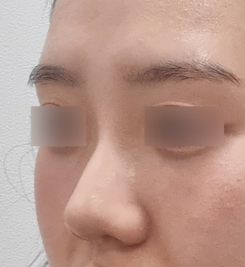 후