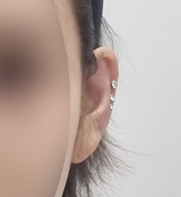 전