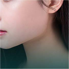 턱 보톡스