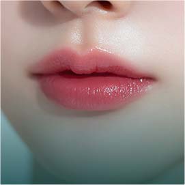 입술 필러