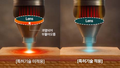 써멀 렌즈 효과 최소화 특허 기술
