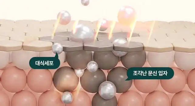고효율 피코레이저 문신제거