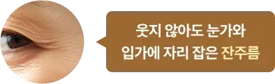 웃지 않아도 눈가와 입가에 자리 잡은 잔주름
