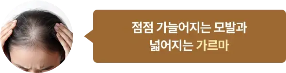 점점 가늘어지는 모발과 넓어지는 가르마
